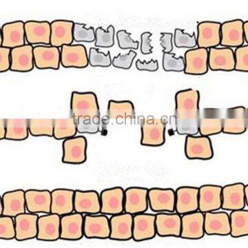 Gynecology Professional Fractional Co2 Laser / Vertical Fractional Co2 Laser Vaginal Tightening photo-3