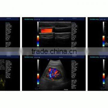 MSLCU01 Best Seller Portable Color Doppler Ultrasound in China