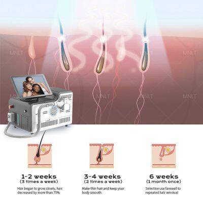 Hospital Use Laser Hair Removal Machine Price photo-5