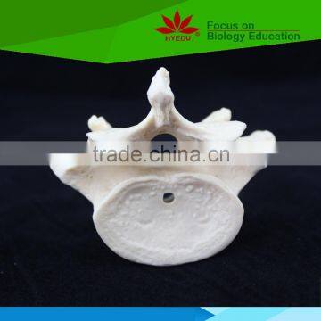 Medical High Quality Human Lumbar Vertebra Model