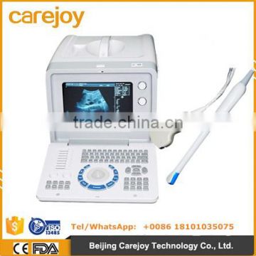 Low cheap portable Ultrasound Scanner 10 inch optional video thermal recorder