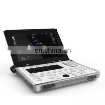 Biggest promotion cheap laptop ultrasound machine/cardiac portable ultrasound scanner with best price