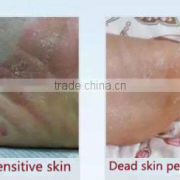Guojia Peeling Foot Mask