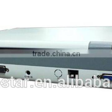 V7 Veterinary Ultrasound Vet Laptop Veterinary Radiology & Ultrasound Machine China photo-5