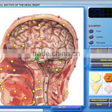 Portable 3D body health analyzer