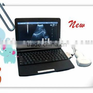 2016 Promotion Price Medical Portable Laptop Clinic Hospital Ultrasound Scanner Machine with Probe--RUS-9000F-Shelly