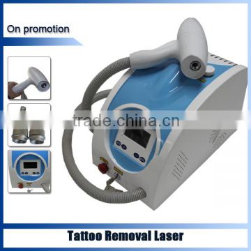 2015 Newest Factory direct sale q switch nd yag laser tattoo removal system device