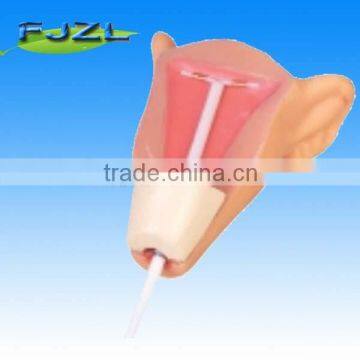 medical educational simulator IUD Training Model