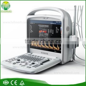 FM-9200T Hot sale Portable Color Doppler for Hospital/Clinial