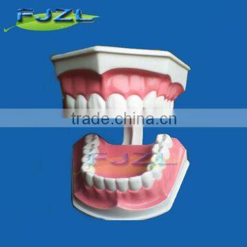 Medical science Dental tooth Care Model (32 Teeth)