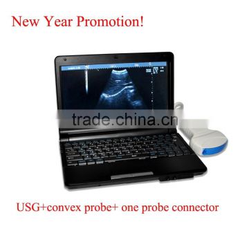 CE approved Laptop Ultrasound Scanner with 3.5Mhz multi-frequency convex probe RUS-9000F