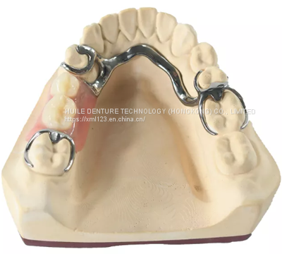 dental lab zirconia removable partial denture