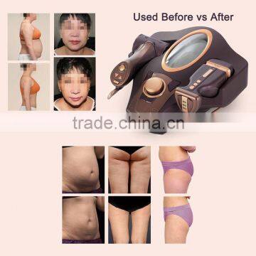 Hot Sell Best Selling Home Use New Korean Technology Professional Slimming Machine photo-3