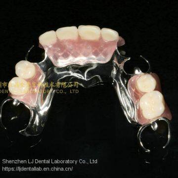 Dental Co-Cr Partial Denture,Titanium Framework Denture, Dental Dentures, Laboratoire Dentaire, Dentallabor, Laboratorio Dental, Dental Laboratory, Shenzhen LJ Dental Lab China photo-5