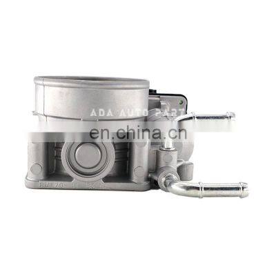 16119-JA10A 16119-JA10B SERA526-01 RME70-11 TB1059 ETB0014 S20059 For Nissan For Infiniti QX60/JX For Renault 70MM Throttle Body