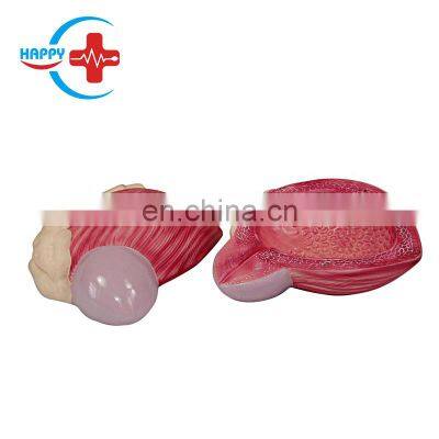 HC-S267 Medical enlarged plastic organ model, Bladder Model, Male Bladder enlargement model