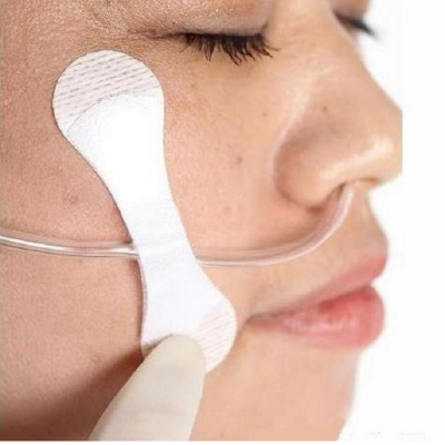 Epidural Catheter Fixation photo-5