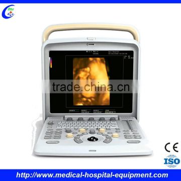 Very Good Imaging 4D Colour Doppler Ultrasound Equipment