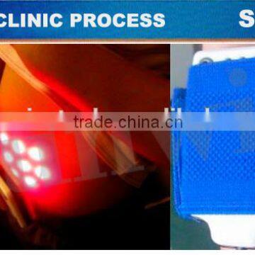 Best Cellulite Fat Removal Machine With Multi Languages System photo-5