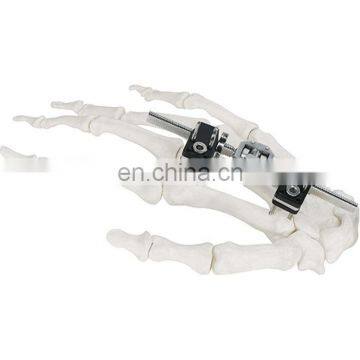 CE & ISO Marked Mini Fragment External Fixator (Finger and Palm) Surgical Instrument photo-2