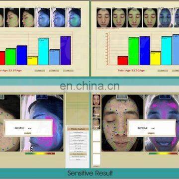 Multi Function Light Facial Skin Analysis Machine for Skin Sensitiveness And Age Test