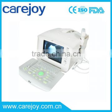 Promotion!!CE approved Portable USB Ultrasound Scanner with 3.5Mhz multi-frequency convex probe RUS-6000A