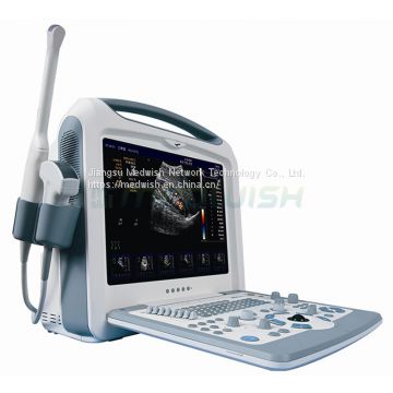 AG-BU2000 Medical Color Doppler Diagnostic Ultrasound Device Laptop Ultrasound Scanner Price