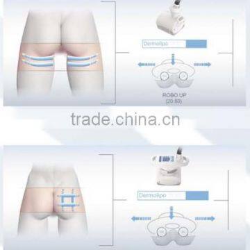 Professional Radio Frequency Cellulite Roller Massage Fat Dissolving Machine - Cellactor photo-6