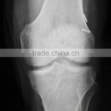 China medical x-ray blue film with CE,used konica minolta bizhub