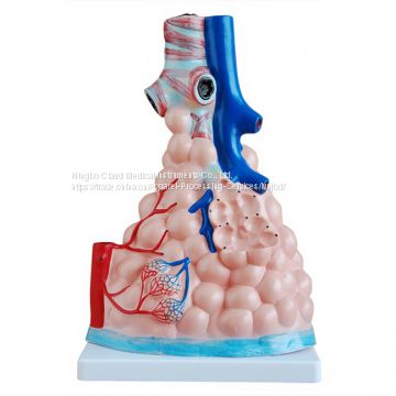 Magnified Pulmonary Alveoli Model