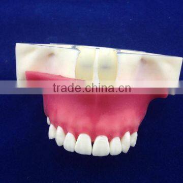 Medical Science Typhoon Dental Education Models photo-2