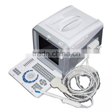 High Quality Ultrasound Machine Medical Equipment Ultrasound Machine Portable photo-2