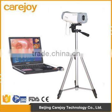 Factory price 2016 hot sale Electronic portable digital video colposcope for gynecology