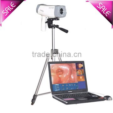 Sale digital Electronic Colposcope with CCD Sony Camera 800,000 pixels with Analysis software Vaginalitis cervical diagnosis