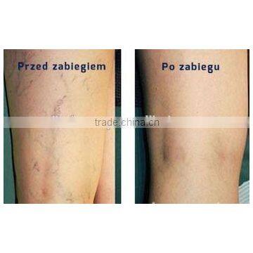 Professional Vascular Vein Stopper 980nm Varicose Veins Removal Diode Laser Machine photo-5
