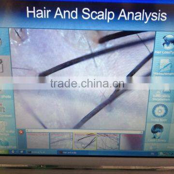 International Distributors Wanted !!! Professional Good Effective Hair Loss Treatment Laser Hair Regrowth Machine/regrowth Hair