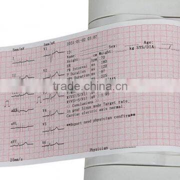 Portable Digital 6-channel Software Electrocardiograph Color Touch Screen ECG Machine EKG Machine EKG-923-Shelly photo-6