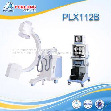 X ray system C-arm PLX112B with competitive price