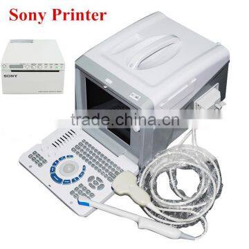 2016 Medical Equipment Hospital CE Approved Digital Style Ultrasound Machine/Scanner For Sale with Cheap Price