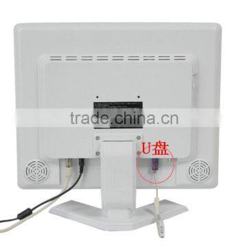 Hot and Best Digital Dental Unit 2016 Hot Sales Intraoral Camera With 3 Million-pixel photo-4