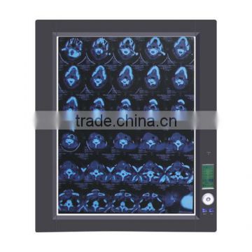 led x ray medical view box