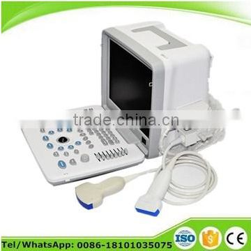 12 inch Portable Ultrasound Scanner with external 3D workstation optional