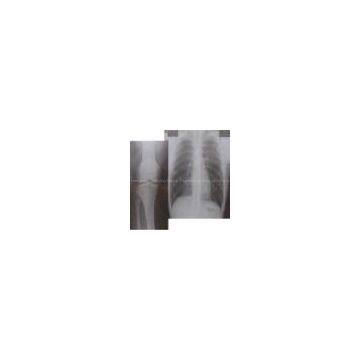 Digital Printer Consumable, Dry Image Films, Medical X-ray Film