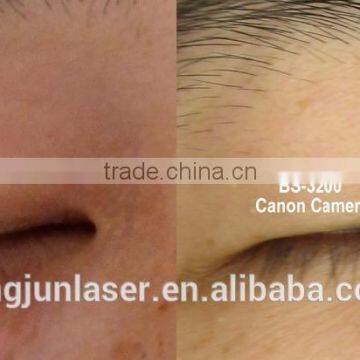 Portable Medical Skin Testing Wood Lamp Skin Scope Analyzer Magic Mirror photo-6