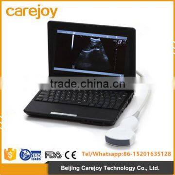 CE & ISO approved Full Digital Laptop Ultrasound Scanner