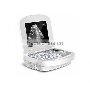China Beijing 10.7 Inch Color LCD 2B Ultrasound Imaging System Laptop Ultrasound Scanner With CE ISO Approved photo-5