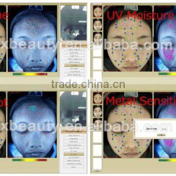 Skin Analyzer uv Damage photo-6