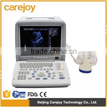 OEM Supply 12 Inch Laptop Ultrasound Scanner Ultrasonic Machine B Ultrasound Scanner for Sale