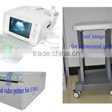 CE Approved Portable B-Mode Ultrasound Scanner With 3.5Mhz Multi-frequency Convex Probe RUS-6000A photo-2