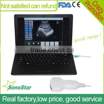 Sonostar Laptop PC based high quality medical cheapest portable ultrasound machine for sale UBook-8